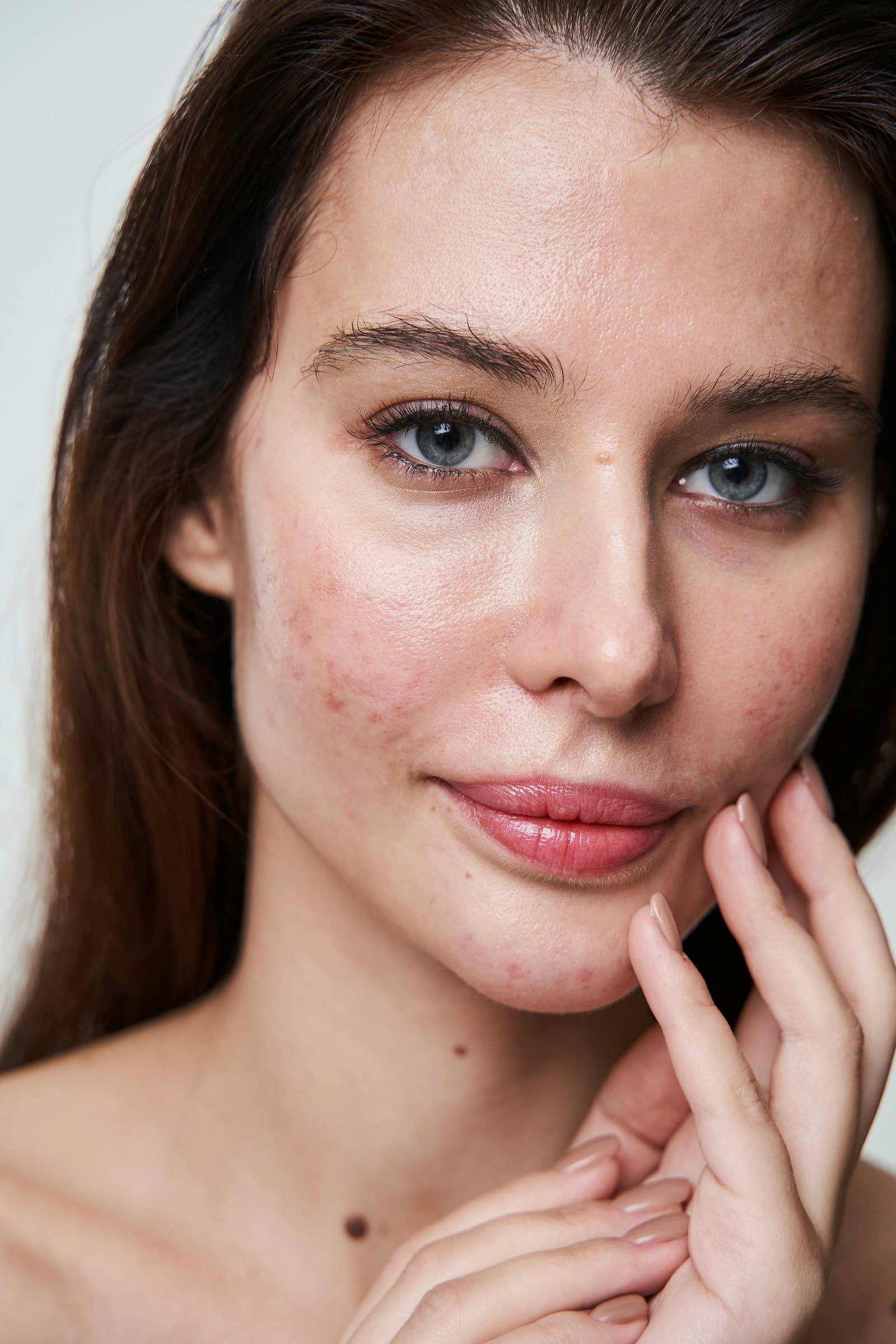 The portrait as shot, before retouching: blemishes on the cheeks and chin